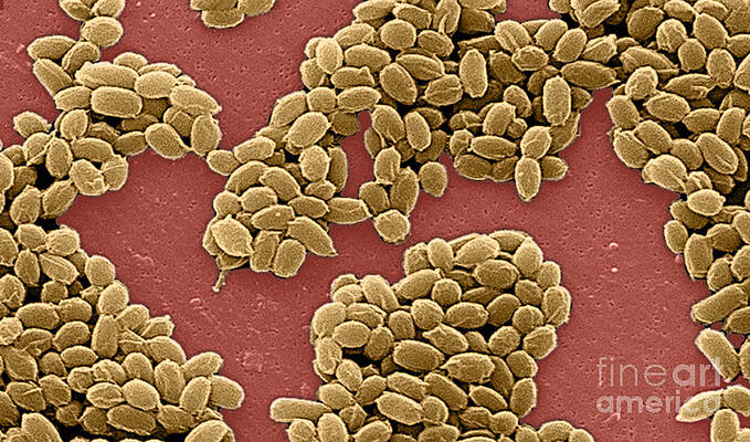 Wall Art - Photograph - Anthrax Bacteria, Sem by Science Source