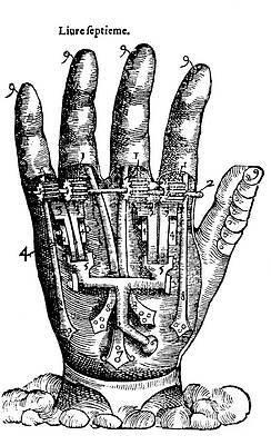 Wall Art - Photograph - Artificial Hand Designed By Ambroise by Science Source