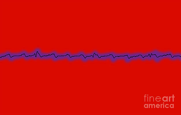 Wall Art - Photograph - Atrial Flutter by Science Source