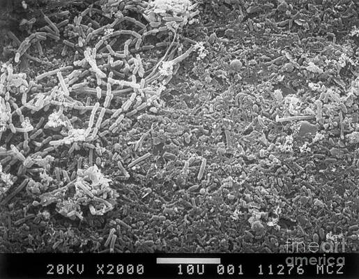 Wall Art - Photograph - Bacteria In Raw Sewage Sem by Science Source