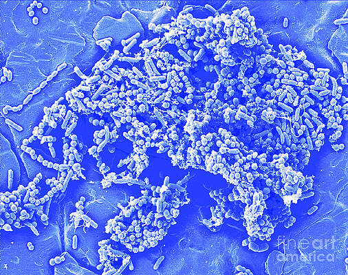 Wall Art - Photograph - Bacterial Composite by Science Source