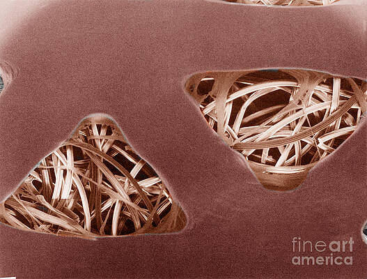 Wall Art - Photograph - Bandage by Science Source