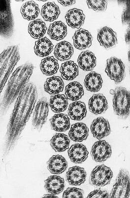 Wall Art - Photograph - Cilia From Ciliates Tem by Omikron
