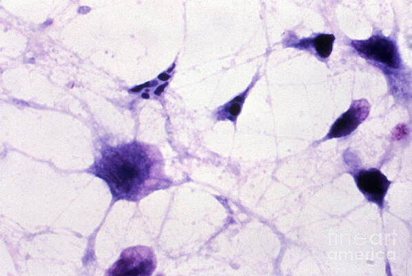 Wall Art - Photograph - Clostridium Difficile, Lm by Science Source