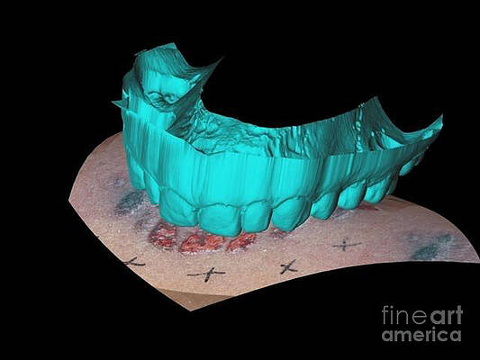 Wall Art - Photograph - Computer Reconstruction Of Bite Mark by Science Source