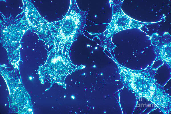 Wall Art - Photograph - Connective Tissue Cells by Science Source