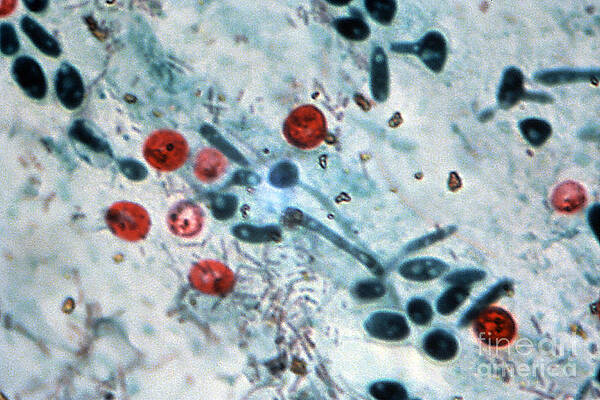 Wall Art - Photograph - Cryptosporidium Oocysts Lm by Science Source