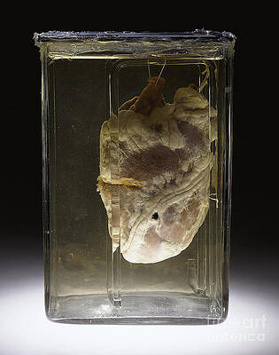 Wall Art - Photograph - Forensic Evidence, Heart Perforated by Science Source