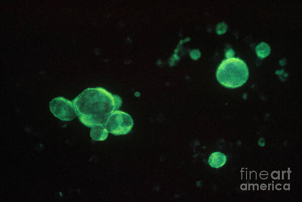 Wall Art - Photograph - Herpes Simplex Virus Lm by ASM/Science Source