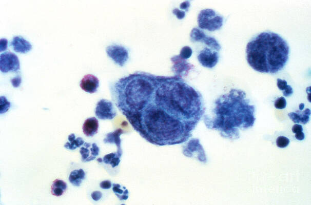 Wall Art - Photograph - Herpes Simplex Virus Lm by Science Source