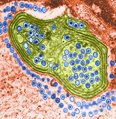 Wall Art - Photograph - Herpes Simplex Virus, Tem by Science Source