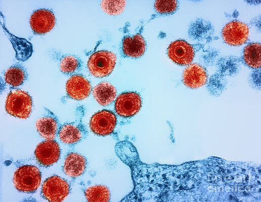 Wall Art - Photograph - Herpes Virus Hhv-6 by Science Source