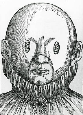 Wall Art - Photograph - Mask For Correcting Crossed Eyes 1583 by Science Source