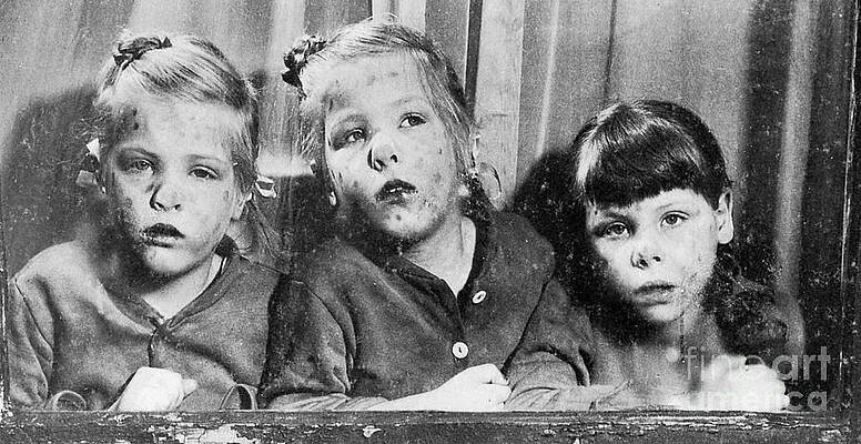 Wall Art - Photograph - Measles by Science Source