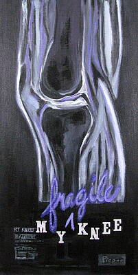 MY fragile KNEE by Betty Pieper MY fragile KNEE by Betty Pieper
