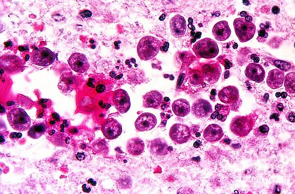 Wall Art - Photograph - Naegleria Fowleri, Lm by Science Source