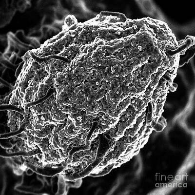 Wall Art - Photograph - Phagocytosis Of Yeast Particle by Science Source