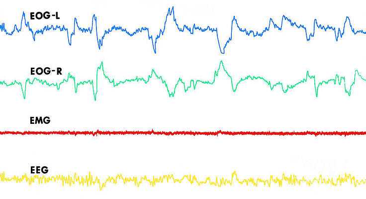 Wall Art - Photograph - Polygraph Tracings Of Rem Sleep by Omikron