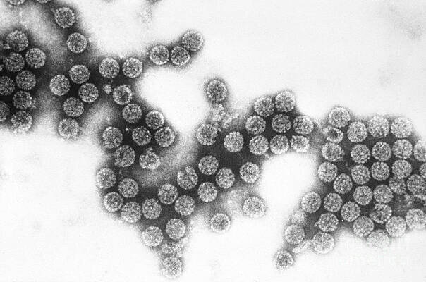 Wall Art - Photograph - Polyoma Virus Sv40 Tem by Science Source