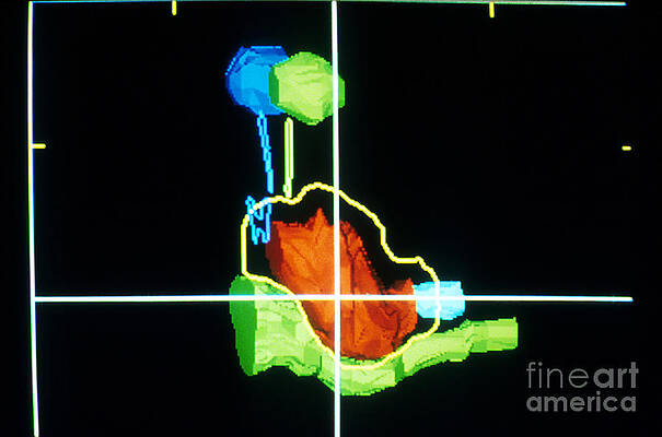 Wall Art - Photograph - Proton Beam From Brain During Ct Scan by Science Source