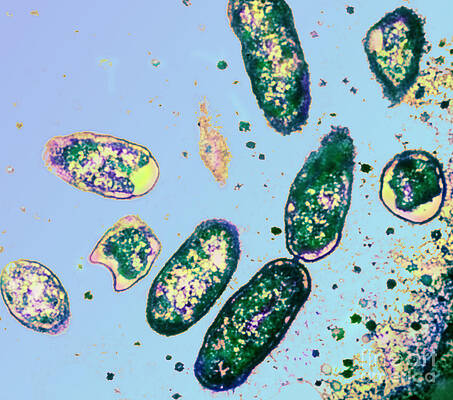 Wall Art - Photograph - Rickettsia Rickettsii by ASM/Science Source