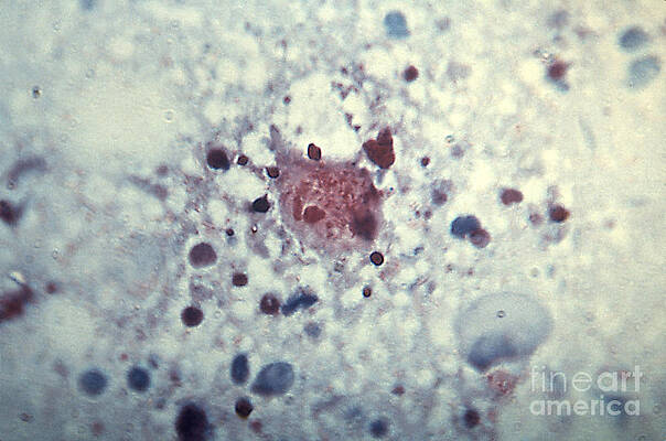 Wall Art -  - Rickettsia Rickettsii by Science Source