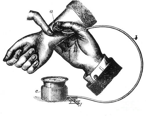 Wall Art - Photograph - Sphygmomanometer, 1883 by Science Source