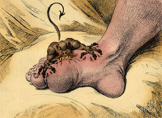 Wall Art - Photograph - The Gout by Science Source