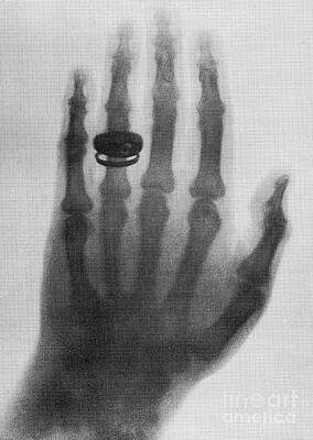 Wall Art - Photograph - X-ray by Science Source
