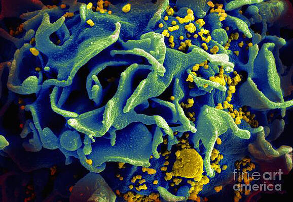 Wall Art - Photograph - Hiv-infected T Cell, Sem #1 by Science Source