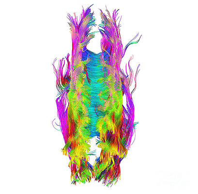 Wall Art - Photograph - Brain Fiber Tracts, Dti Scan #3 by Living Art Enterprises
