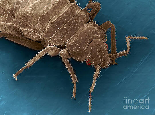 Wall Art - Photograph - Bedbug, Cimex Lectularius, Sem #5 by Ted Kinsman