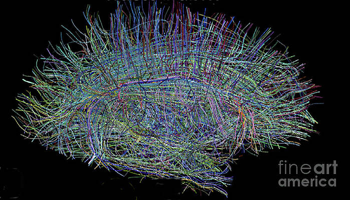 Wall Art - Photograph - Neural Fibers In Human Brain by Science Source