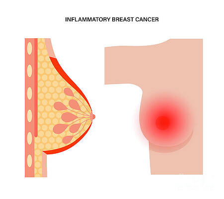 Female Breast Anatomy #4 by Pikovit / Science Photo Library