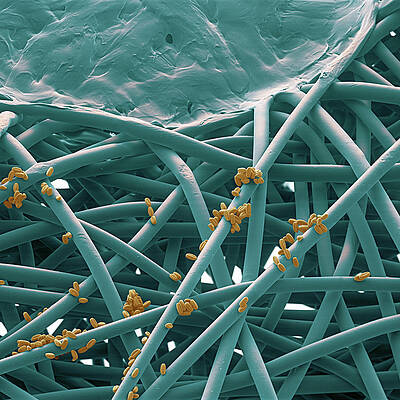 Wall Art - Photograph - Surgical Mask With Pollen Grains, Sem #2 by Oliver Meckes EYE OF SCIENCE