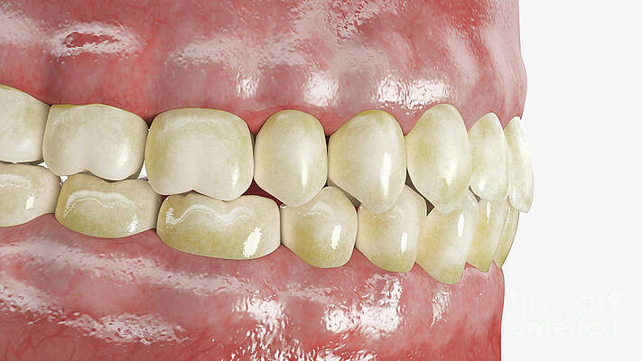Wall Art - Photograph - Dirty Teeth #3 by Science Photo Library