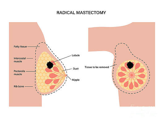 Female Breast Anatomy #4 by Pikovit / Science Photo Library