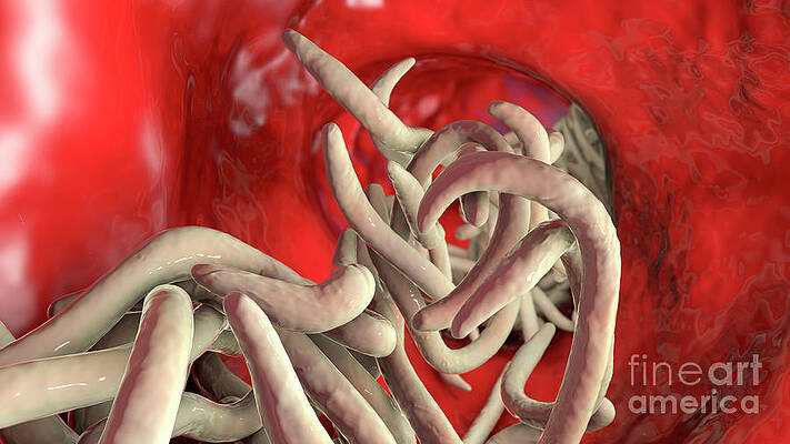 Round Worms In Human Intestine #29 Metal Print by Kateryna Kon