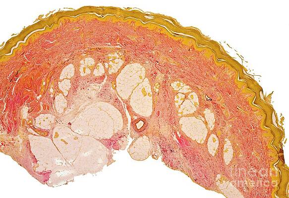 Wall Art - Photograph - Skin #6 by Science Photo Library