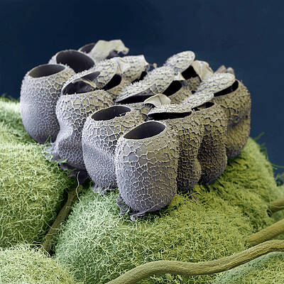 Wall Art - Photograph - Heteroptera Egg Nest, Sem by Oliver Meckes EYE OF SCIENCE