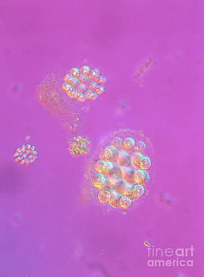 Wall Art - Photograph - Lm Of Several Colonies Of Eudorina by Science Photo Library