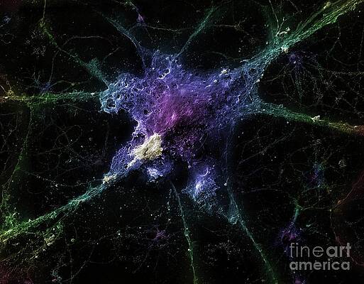 Wall Art - Photograph - Neuron With Amyloid Beta Peptide by Science Photo Library