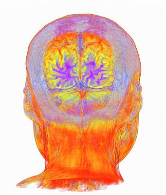 Wall Art - Photograph - Visual Cortex In The Brain by Science Photo Library