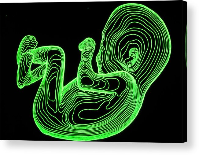 Body Contour Mapping Acrylic Print featuring the photograph Body Contour Map Of 14-week-old Foetus #1 by Dr Robin Williams/science Photo Library