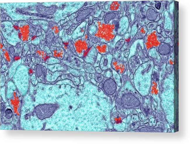 Anatomical Acrylic Print featuring the photograph Brain Synapses #1 by Steve Gschmeissner/science Photo Library