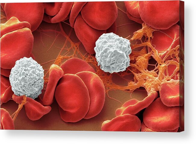 Biological Acrylic Print featuring the photograph Blood From Wound Site #40 by Steve Gschmeissner/science Photo Library