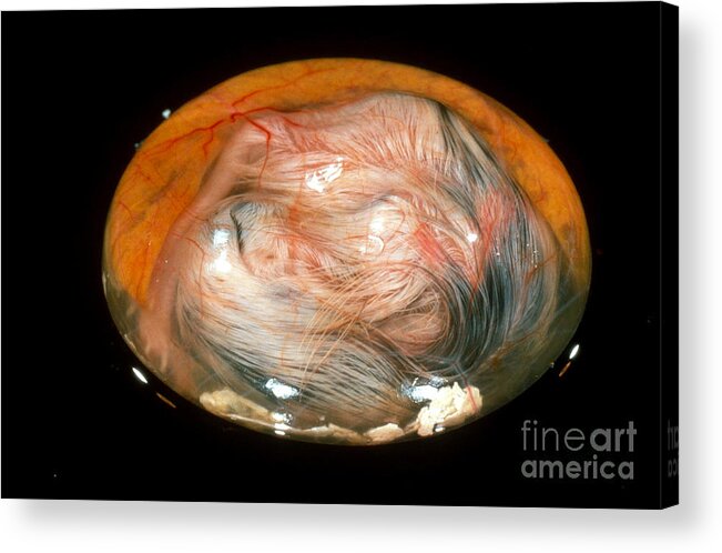 Chicken Acrylic Print featuring the photograph Chick Embryo On 17th Day by Jerome Wexler