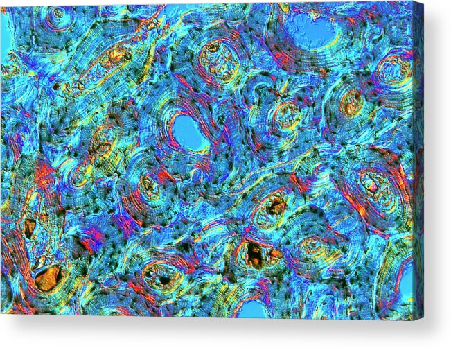 Magnified Image Acrylic Print featuring the photograph Lm Of Human Compact Bone by Alfred Pasieka/science Photo Library