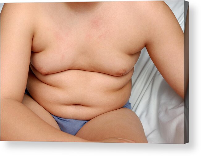 Child Acrylic Print featuring the photograph Obesity by Tibor5