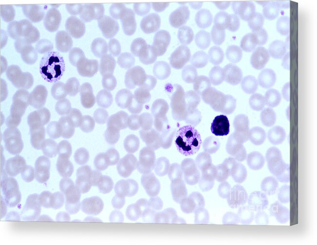 Light Microscopy Acrylic Print featuring the photograph Human Blood Smear by M. I. Walker